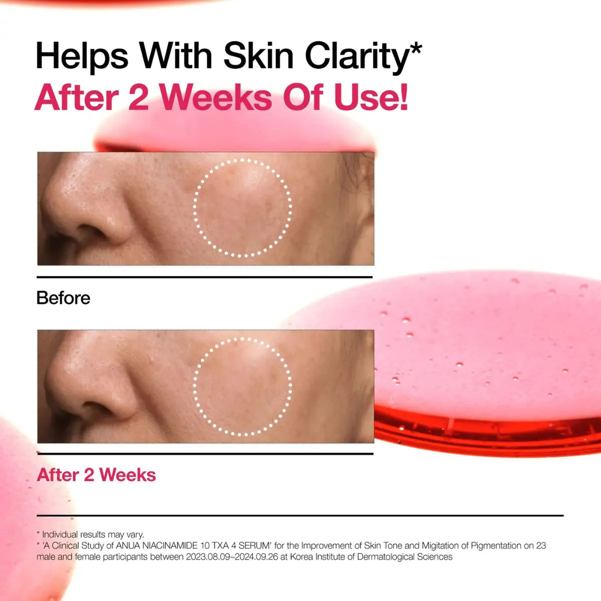 Niacinamide 10% + TXA 4% Serum 30mL Anua
