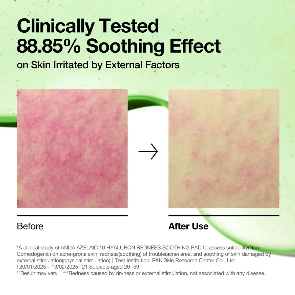 Azelaic Acid 10 Hyaluron Redness Soothing Pad 90ea Anua