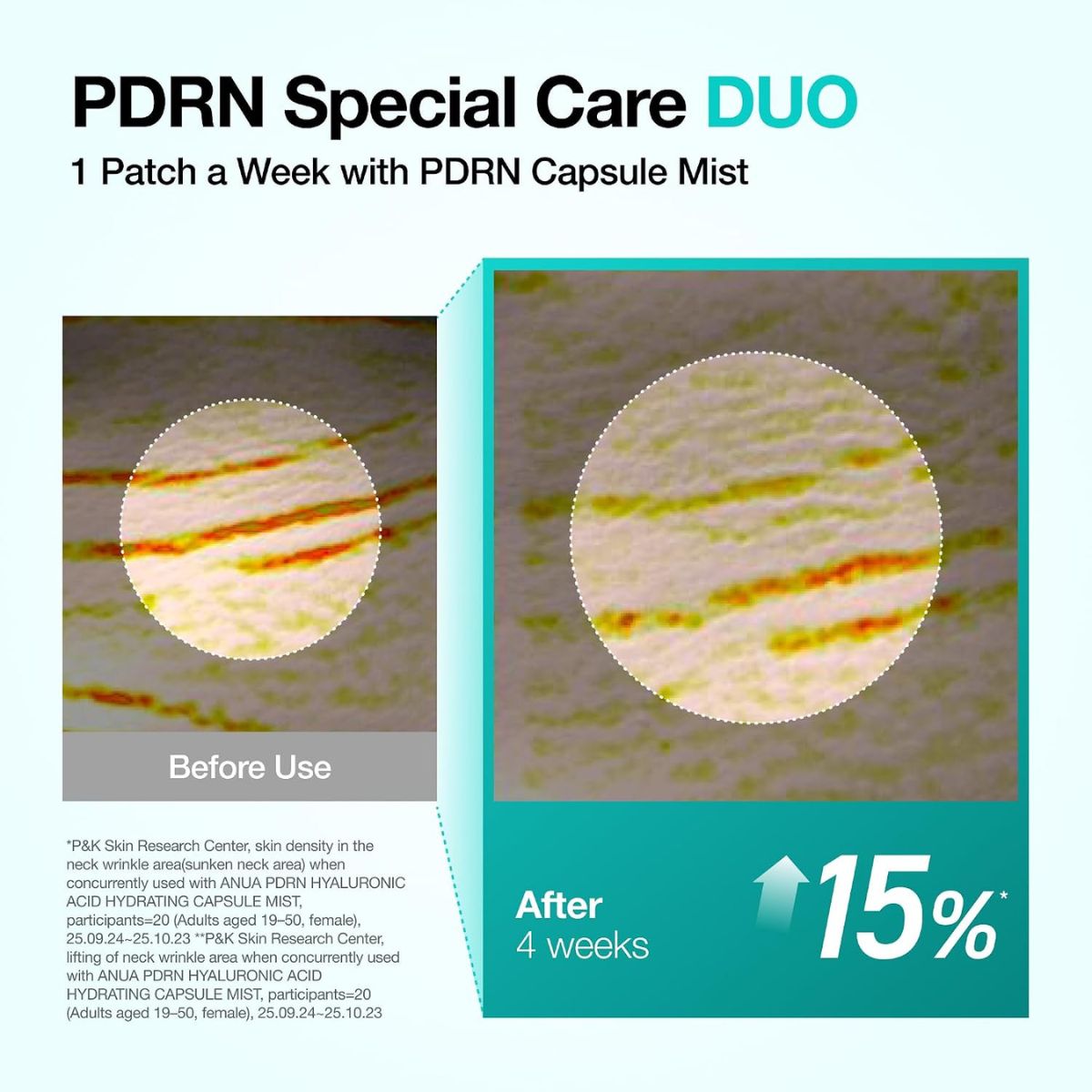 PDRN Collagen Melting Patch For Neck (4ea)