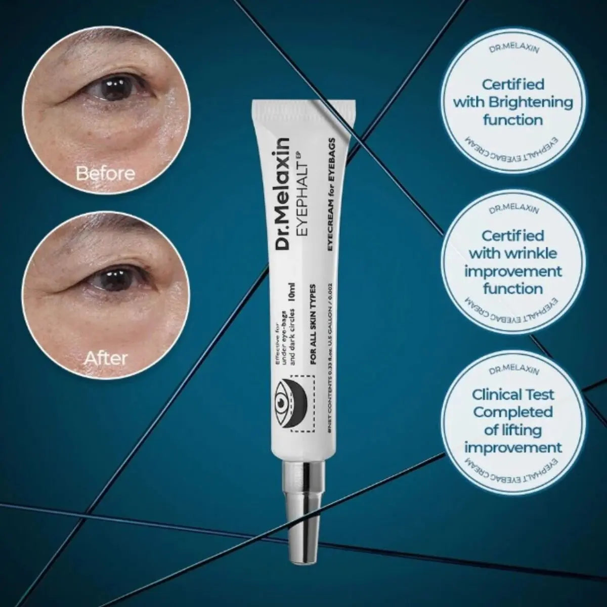 Eyephalt Eyebag Cream 10mL Dr.Melaxin