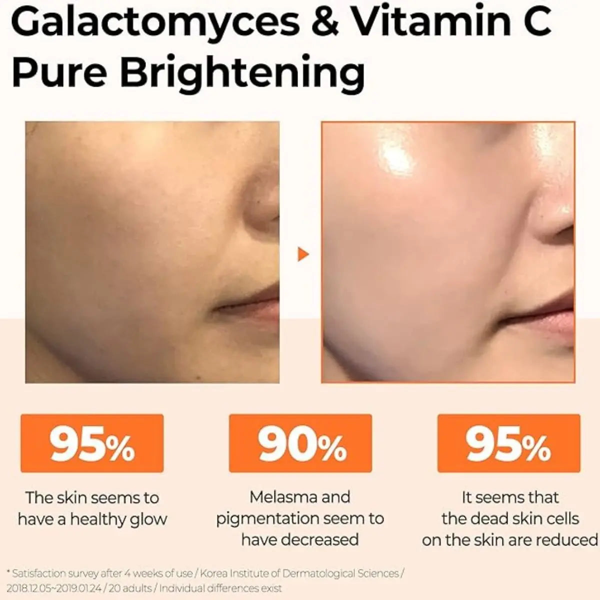 Galactomyces Pure Vitamin C Glow Serum 30mL Somebymi