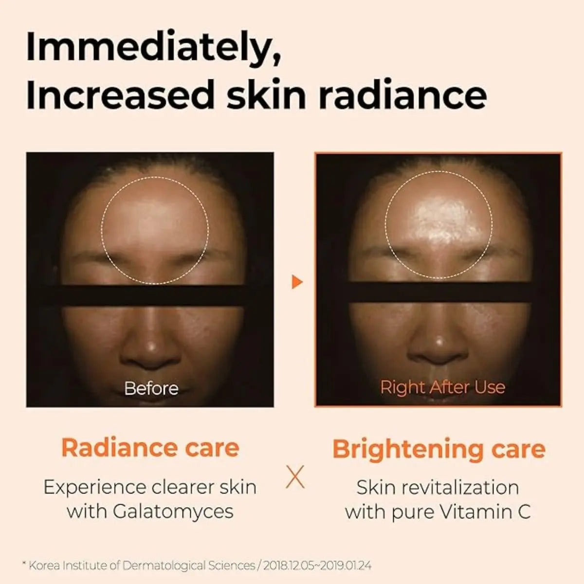 Galactomyces Pure Vitamin C Glow Serum 30mL Somebymi