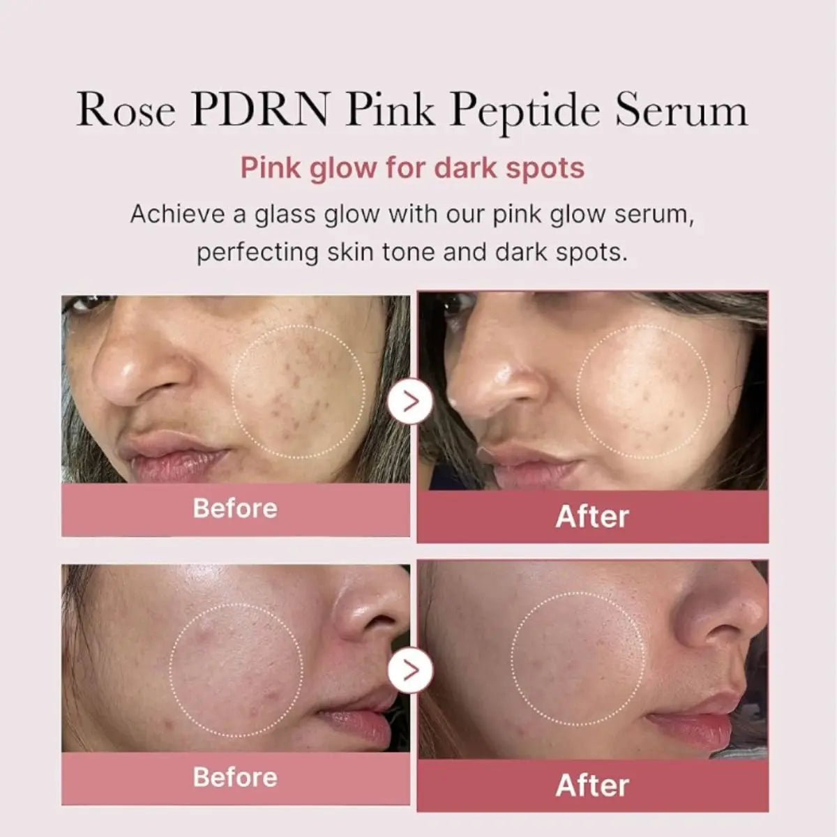 PDRN Pink Peptide Serum 30mL Medicube