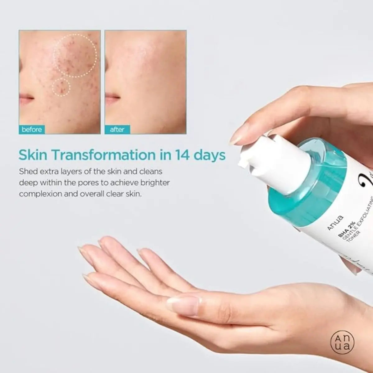 BHA 2% Gentle Exfoliating Toner 150mL Anua