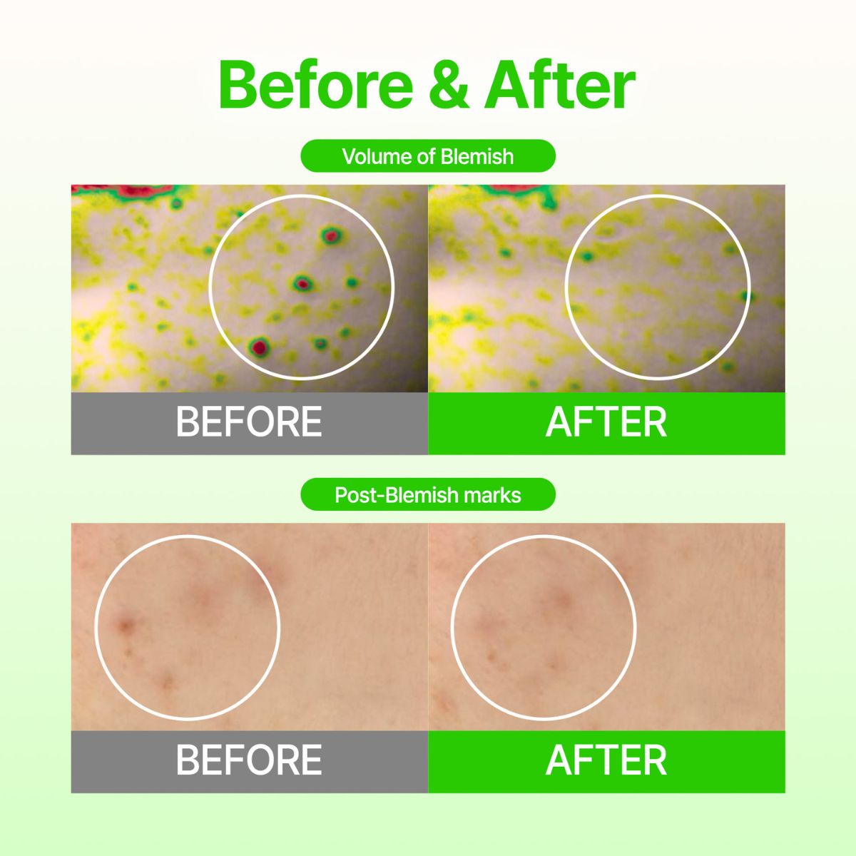 Dark Spot Care Microcone Patch (6 patches)