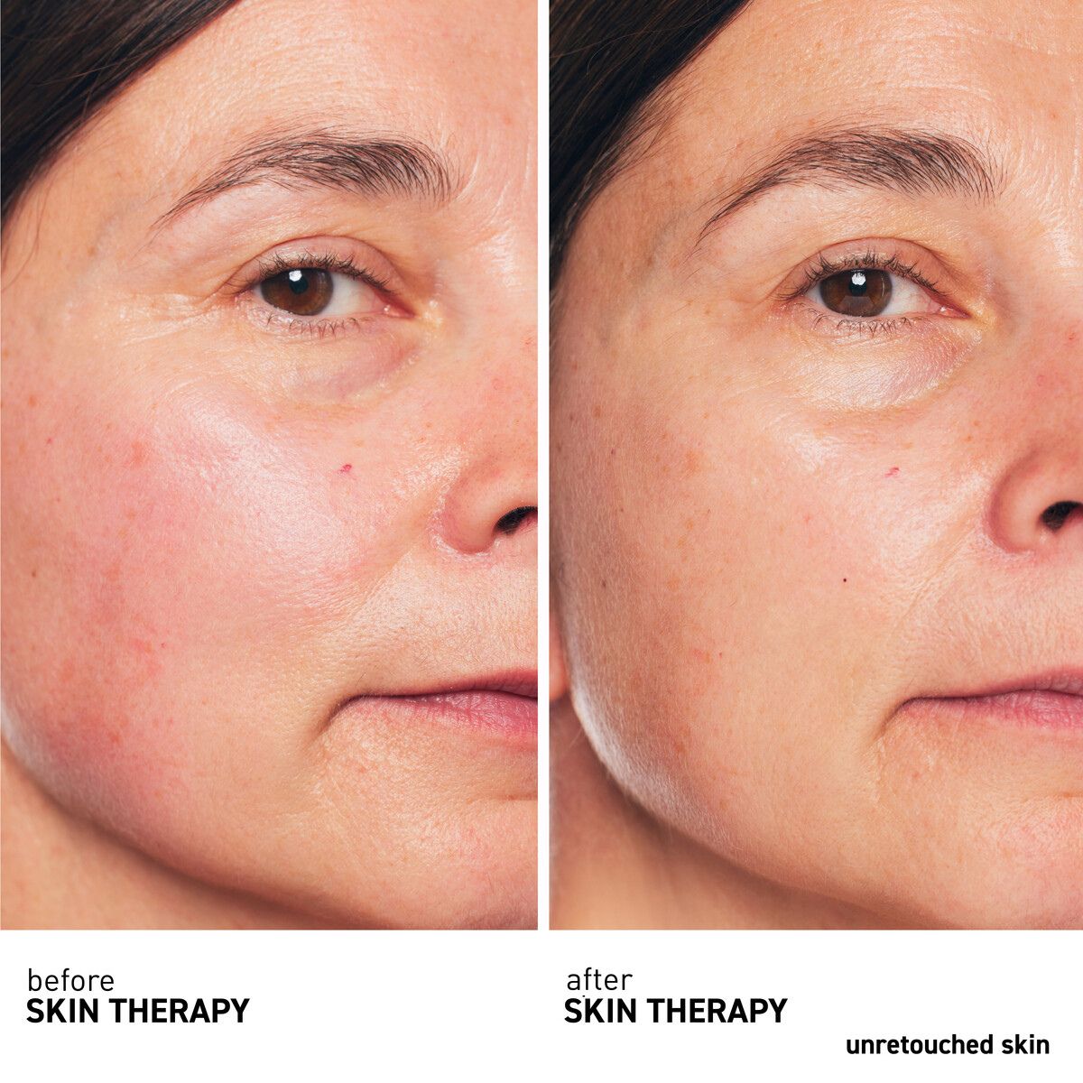 Skin Therapy Milky Lotion 30mL