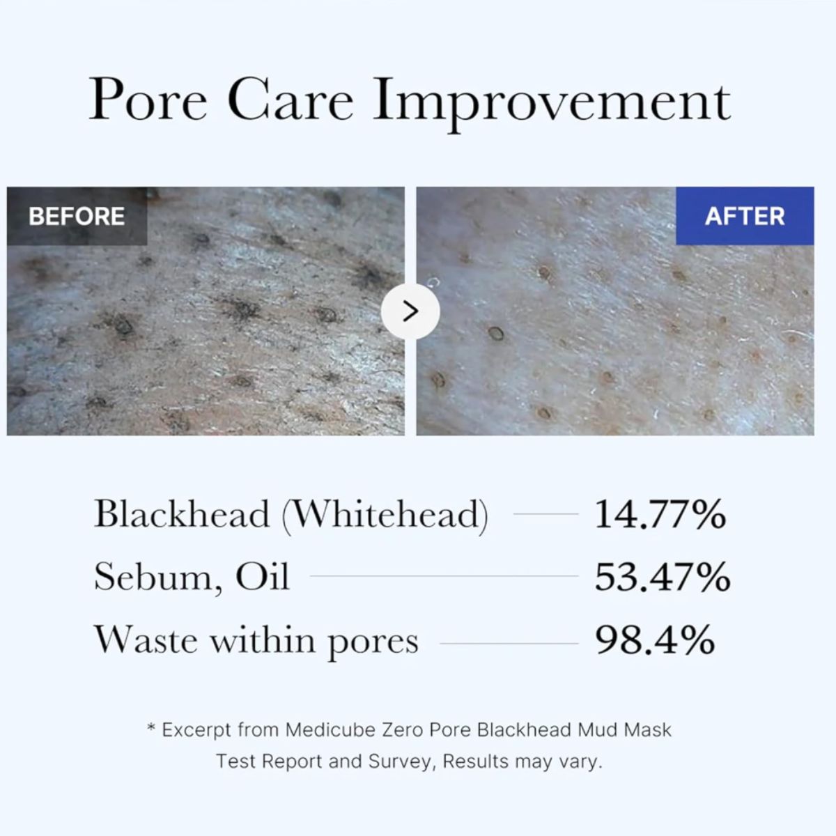 Zero Pore Blackhead Mud Mask 100g
