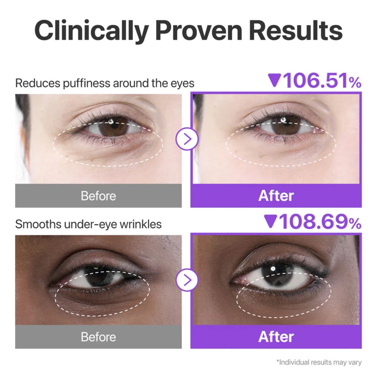 No. 9 NAD+ Collagen Under Eye Patches