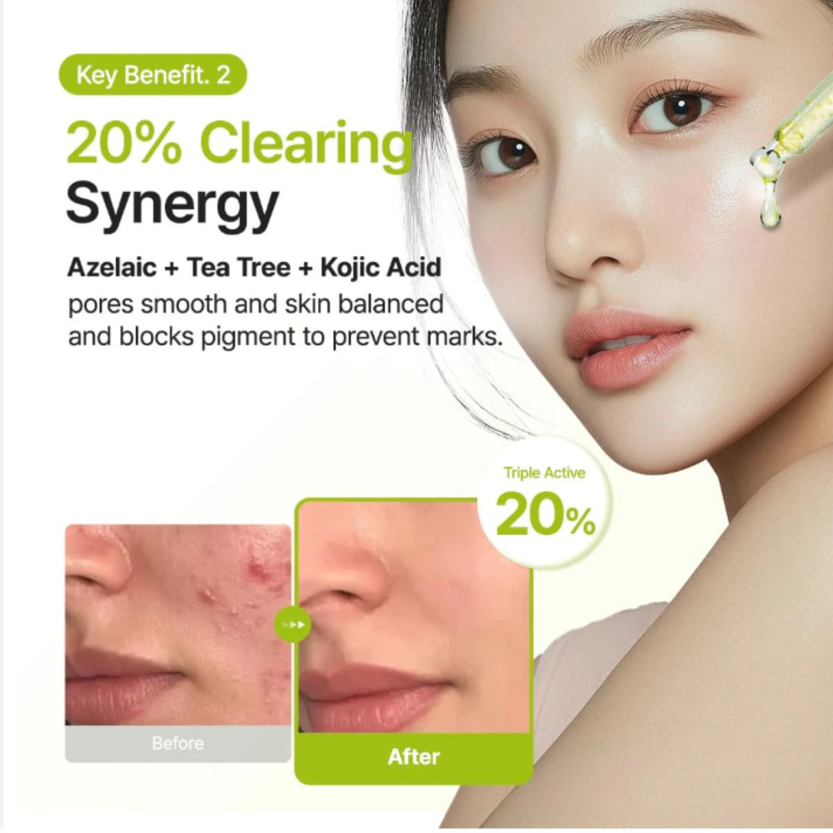 Azelaic Acid 10 Kojic Azulene Serum 30mL