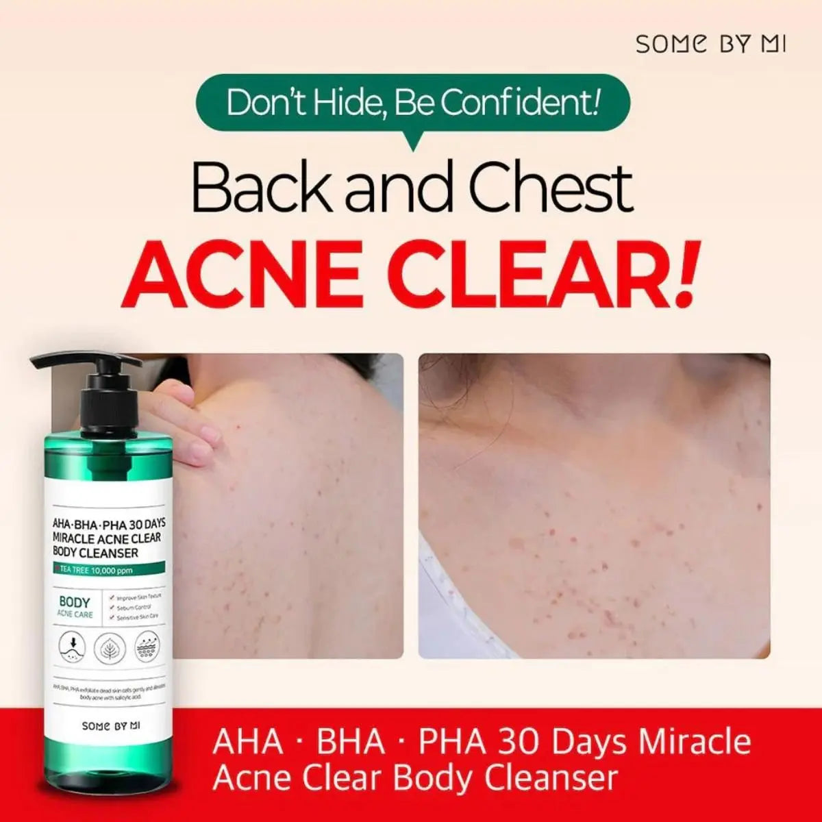AHA BHA PHA 30 Days Miracle Clear Body Cleanser 400g Somebymi
