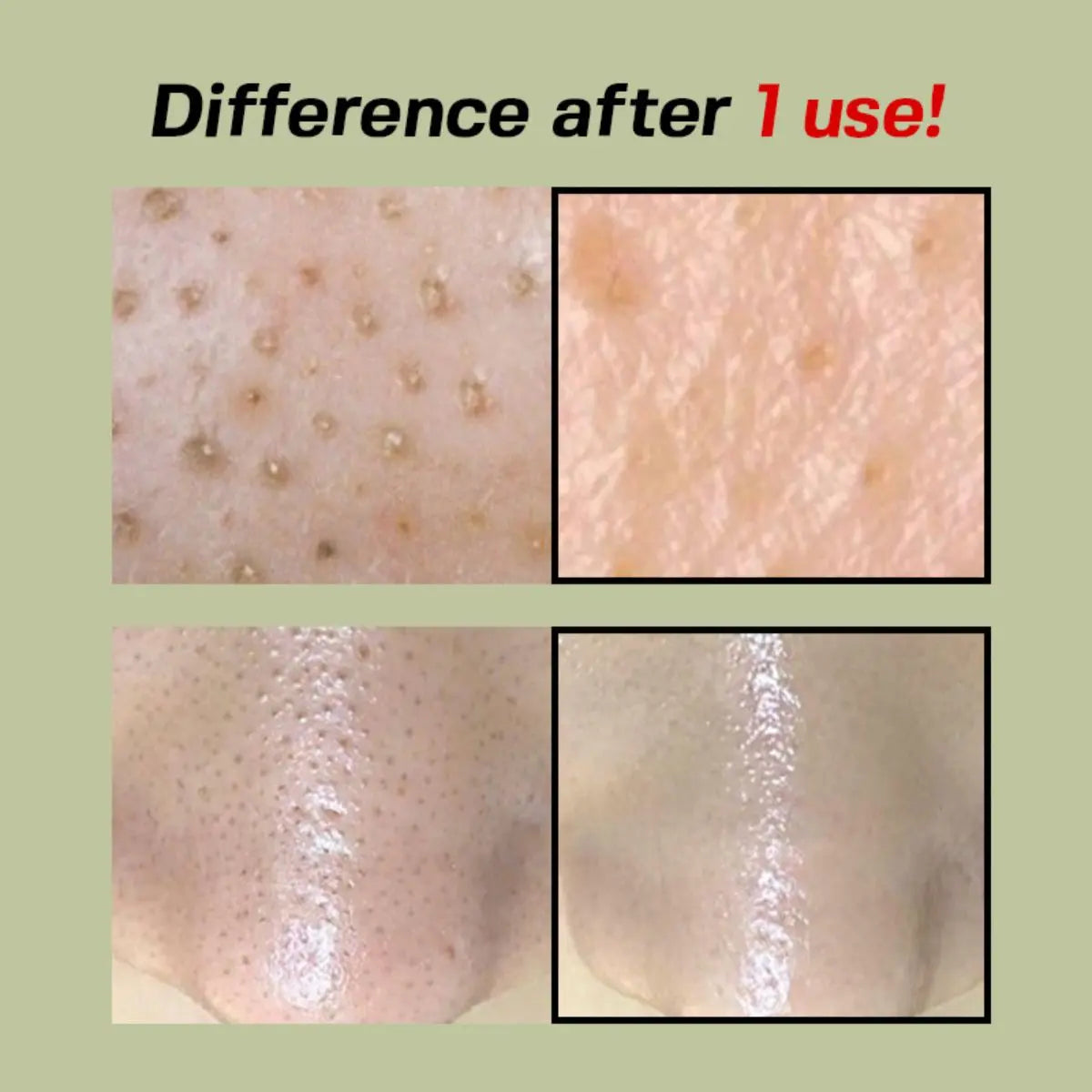 Green Tomato Pore Peeling Jumbo Pad (60ea) Sungboon Editor