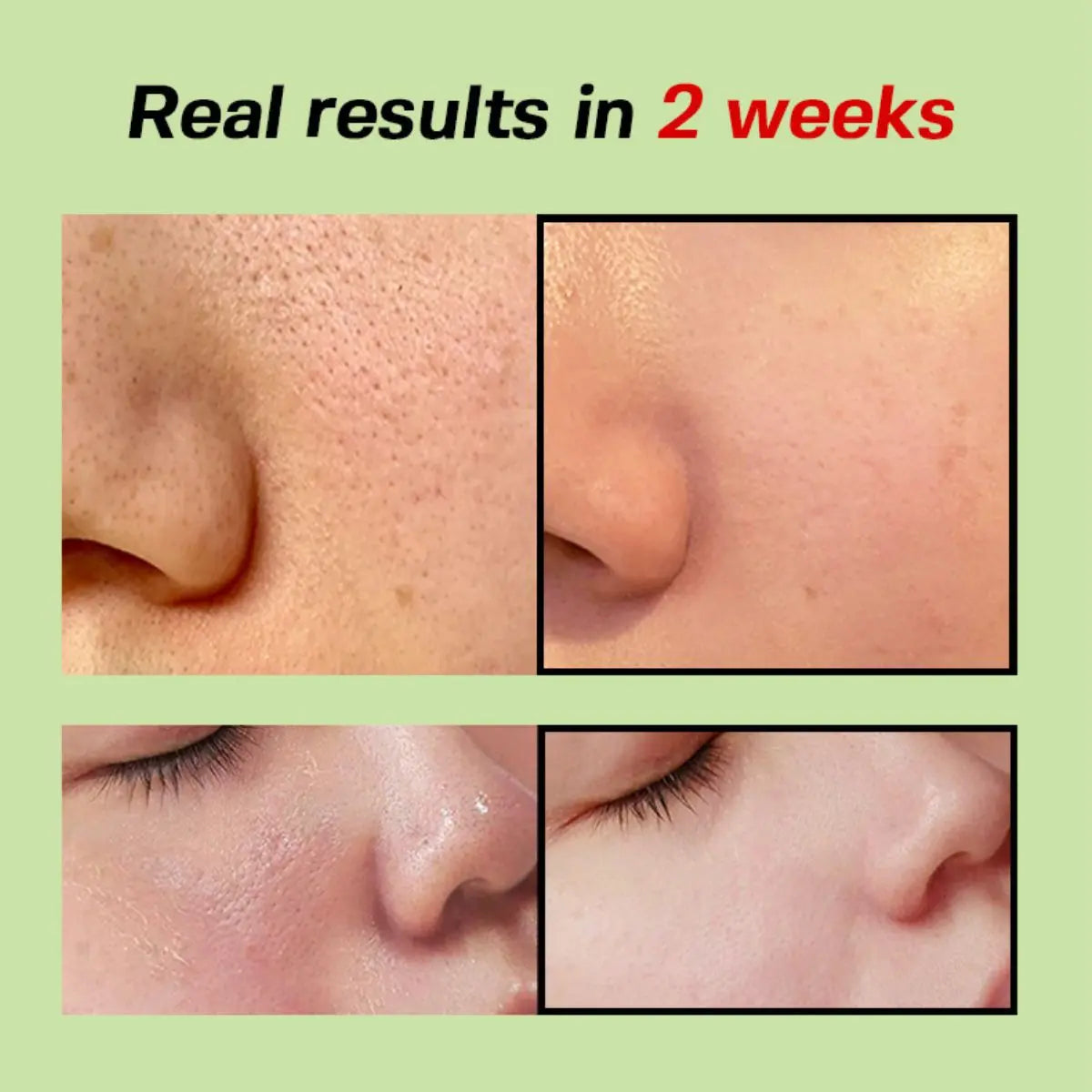 Green Tomato Pore Lifting Ampoule+ 30mL Sungboon Editor