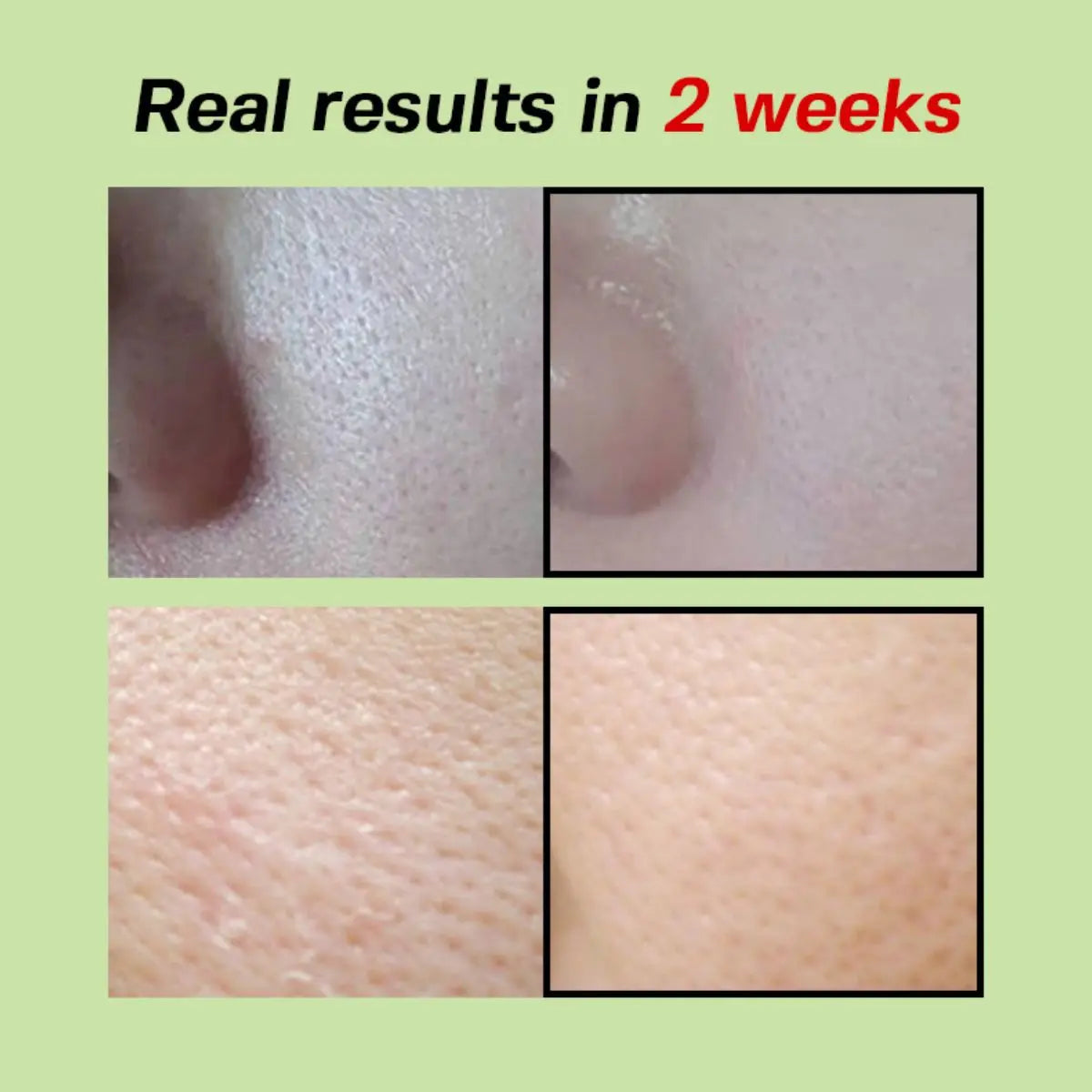 Green Tomato Pore Lifting Ampoule+ 30mL Sungboon Editor